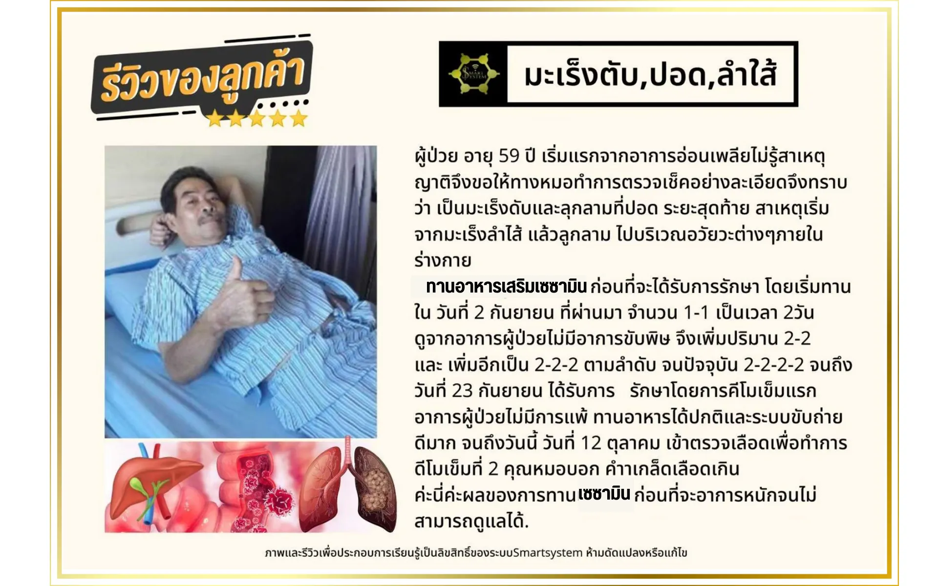 รักษามะเร็งปอด มะเร็งตับ ระยะสุดท้าย